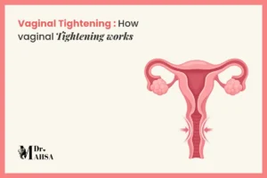 How vaginal tightening works, with an anatomical illustration of the uterus and vaginal canal