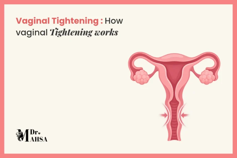 How vaginal tightening works, with an anatomical illustration of the uterus and vaginal canal