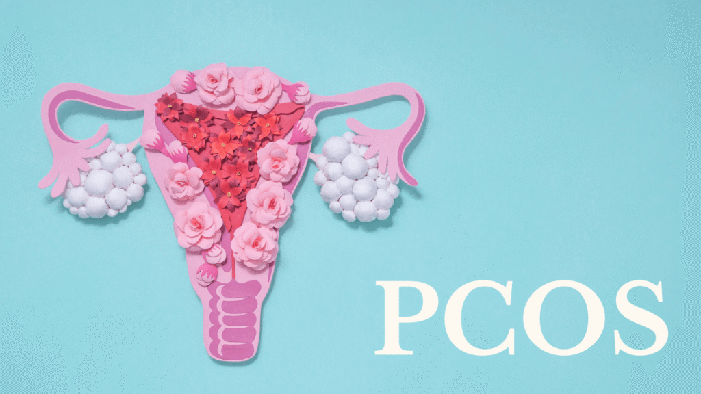 Polycystic Ovary Syndrome (PCOS)