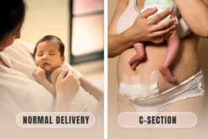 Comparison showing a mother and newborn after vaginal delivery alongside a mother and baby after C-section